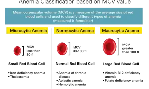 Porównanie wielkości erytrocytów: mikrocytarna anemia (małe), normocytarna (normalne), makrocytarna (duże). Niskie erytrocyty mogą oznaczać mikrocytarną anemię.