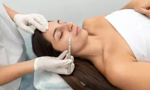 Profesional realiza procedimiento de mesoterapia con dermapen en el rostro de una mujer, mejorando su piel.