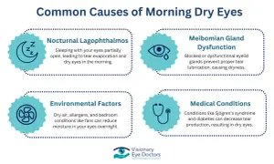 Nocturnal lagophthalmos: sleeping with your eyes partially open causes tear evaporation and dry eyes.