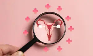 Powiększona macica i jajniki pod lupą, otoczone różowymi krzyżykami. Ilustracja symbolizuje diagnostykę i leczenie PCOS objawów.