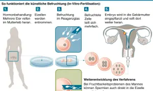 Schema erklärt die IVF-Bedeutung: Hormonbehandlung, Eizellentnahme, Befruchtung im Reagenzglas, Zellteilung, Embryotransfer in die Gebärmutter.