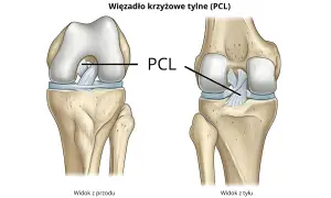 Anatomia stawu kolanowego: widok z przodu i z tyłu, ukazujący kości kończyny dolnej i więzadło krzyżowe tylne (PCL).