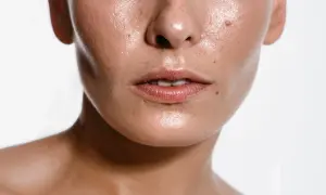 Błyszcząca skóra, widoczne pory i piegi. Czy to naturalny **sebum co to** za zjawisko?
