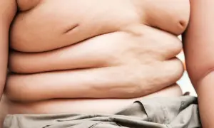 Otyłość: Operacja zmniejszenia żołądka na NFZ? Sprawdź, jak!