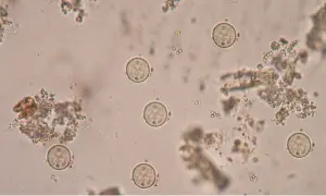 Mikroskopowe zdjęcie jaj owsików, kluczowe w zrozumieniu, jak pozbyć się owsików bez leków. Widać liczne, okrągłe jaja.