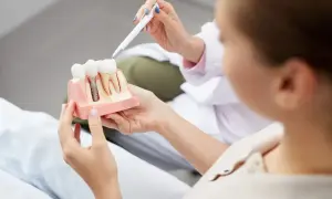 Dentysta wyjaśnia pacjentce budowę implantu zębowego, odpowiadając na pytanie: czy implanty są bezpieczne.