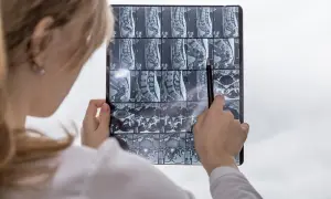 Läkare undersöker MR-bilder av ryggraden, pekar på en möjlig protrusion.