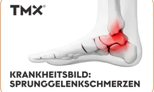 Anatomische Darstellung eines Fußes mit rot hervorgehobenen Bereichen, die Sprunggelenkschmerzen anzeigen. TMX-Logo oben.