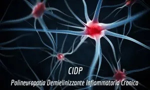 Neuroni stilizzati con testo "CIDP Polineuropatia Demielinizzante Infiammatoria Cronica", che può causare invalidità.