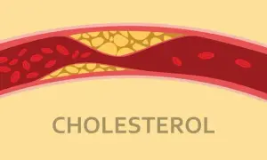 Czym jest cholesterol? Rola, rodzaje i skutki dla zdrowia – wszystko, co musisz wiedzieć