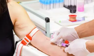 Pobieranie krwi do badań. Pamiętaj, czego nie jeść przed badaniem cholesterolu, by wyniki były wiarygodne.