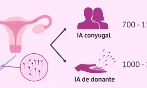 IA conyugal: 700-1100€. IA donante: 1000-1700€. Descubre cuanto cuesta una inseminación artificial en España.