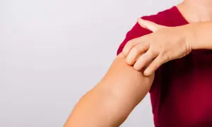 Eine Hand kratzt sich am Arm. Vielleicht hilft **Essig gegen Juckreiz**?