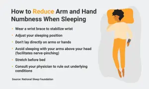 Tips to reduce numbness in hands while sleeping: adjust position, avoid arm pressure, stretch, and consult a doctor.