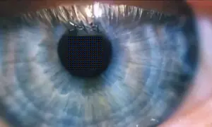 Un occhio umano, con un reticolo di pixel sovrapposto, suggerisce quanti pixel ha l'occhio umano.
