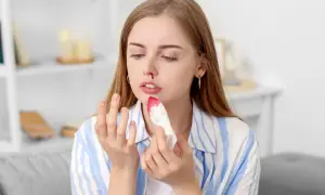 Kobieta z krwawiącym nosem, być może objaw choroby von Willebranda, przykłada chusteczkę.