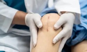 Rehabilitacja po endoprotezie kolana: Ile trwa i co musisz wiedzieć?