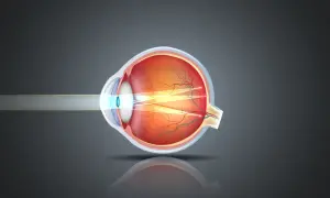 Astygmatyzm: Okulista czy Optometrysta? Sprawdź, kogo wybrać!