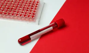 Próbka krwi w probówce i płytka z dołkami do analizy. Zastanawiasz się, ile kosztuje badanie AMH?
