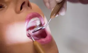 Badanie jamy ustnej, widoczna błona śluzowa i narzędzia dentystyczne.