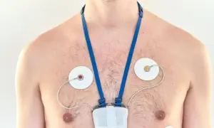 Mężczyzna z przyklejonymi elektrodami i urządzeniem na klatce piersiowej, monitorującym jego serce. To holter ciśnieniowy.