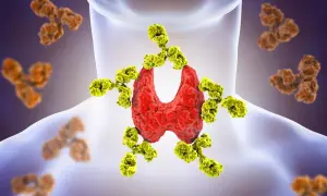 Tarczyca atakowana przez żółte przeciwciała, ilustracja chorób autoimmunologicznych.