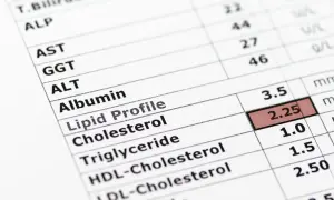 Wynik lipidogramu: trójglicerydy za niskie (1.0). Widoczne inne parametry jak cholesterol, HDL, LDL.