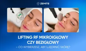 Zabieg RF na twarz: mikronakłuwanie czy bezinwazyjny lifting? Dwa sposoby na jędrną skórę.