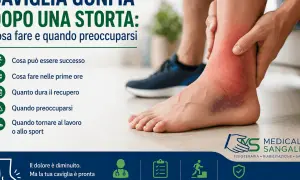 Caviglia gonfia e livida dopo una storta. Scopri cosa fare e quando preoccuparsi, anche con rimedi della nonna per la distorsione caviglia.