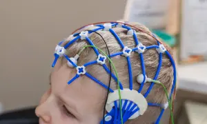 Barn med EEG-hjälm för utredning av adhd behandling.