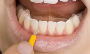 Un primo piano di denti bianchi e gengive sane, con un piccolo scovolino giallo che pulisce tra gli incisivi. La domanda è: il filo interdentale si passa prima o dopo lo spazzolino?