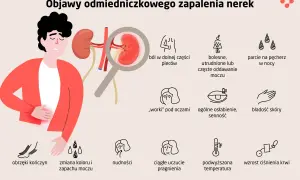 Ilustracja przedstawia objawy zakażenia nerek: ból pleców, problemy z oddawaniem moczu, obrzęki, nudności, gorączkę i inne.