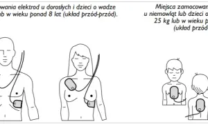AED: Kiedy NIE używać? Sprawdź przeciwwskazania i mity