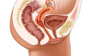 Illustration anatomique du pelvis féminin montrant le rectum, la vessie, l'utérus et les ligaments. Une condition comme le prolapsus vaginal peut affecter ces organes.