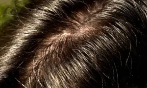 Primo piano di capelli scuri e lucidi, con alcune ciocche che mostrano la tendenza ad apparire unti.