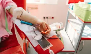 Proces flebotomii: krew płynie z ręki do worka.