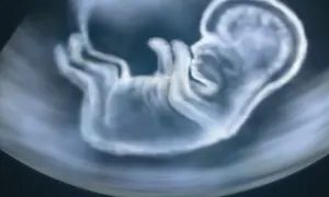 Obraz USG przedstawia płód. Ważne jest, jak długo martwy płód może pozostać w macicy, aby uniknąć powikłań.