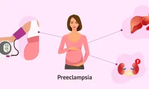 Ilustración de una mujer embarazada con un tensiómetro, hígado y riñones, mostrando los **preeclampsia riesgos** y sus efectos.
