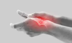 Schmerzende Hand mit gerötetem processus styloideus radii.