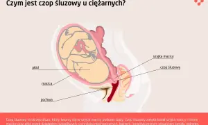 Ilustracja przedstawia przekrój przez ciążową macicę z płodem. Widoczny jest czop śluzowy zamykający szyjkę macicy.