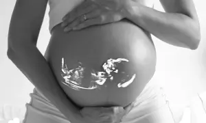 En gravid mage med ett tidigt ultraljud av ett foster projicerat på huden. Händerna vilar mjukt på magen.