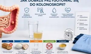 Model jelita grubego, wskazówki dotyczące przygotowania do kolonoskopii, w tym dieta, klarowne płyny i preparat przeczyszczający. Plan obejmuje 7 dni, 3 dni, 1 dzień przed badaniem, dzień badania i po badaniu.