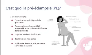 Illustration expliquant la pré-éclampsie et ses symptômes : maux de tête, troubles de la vue, hypertension, nausées, vomissements, protéinurie, sifflements d'oreilles et gonflements.