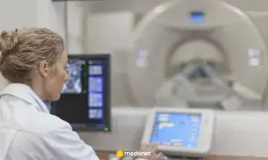 Lekarka w białym fartuchu analizuje obraz z rezonansu magnetycznego na monitorze.