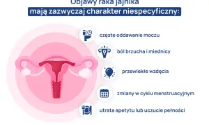 Grafika przedstawia narządy rodne kobiety i objawy raka jajnika: ból brzucha, częste oddawanie moczu, wzdęcia, zmiany cyklu, utratę apetytu. Test Roma może pomóc w diagnostyce.