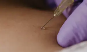 Gros plan sur une aiguille fine pour une infiltration du dos, une goutte de liquide prête à être injectée.