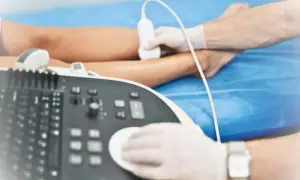 USG Doppler żył NFZ: Jak uzyskać badanie krok po kroku?