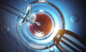 Sperm wstrzykiwany do komórki jajowej. Zastanawiasz się, ile kosztuje in vitro?