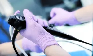 Dłoń w fioletowej rękawiczce trzyma endoskop. Przed gastroskopią należy skonsultować z lekarzem, jakich leków nie można brać.
