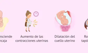 Ilustración de las etapas del parto normal: bebé encajado, contracciones, dilatación y rotura del tapón mucoso.